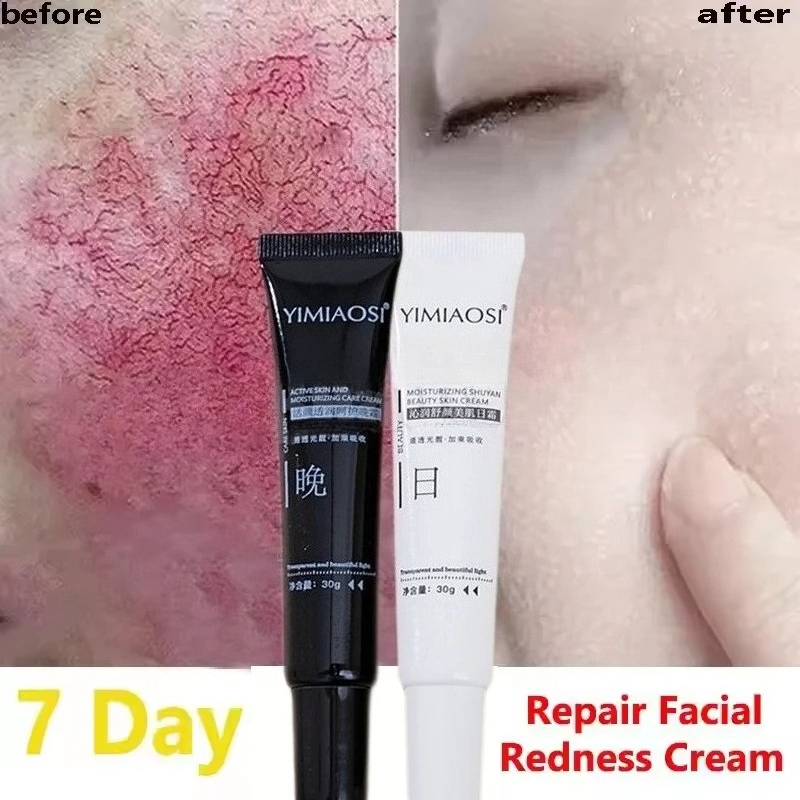 Coenzyme Q10 Cream - Корейский крем для лица от покраснений,