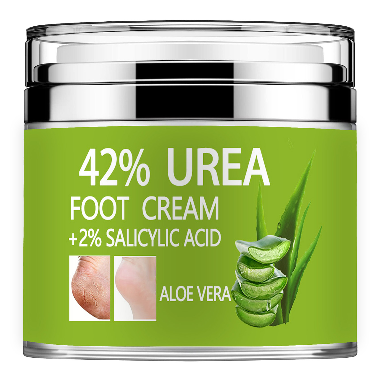 Azelaic Acid Cream - Крем мочевины 42% Плюс Салициловая кислота