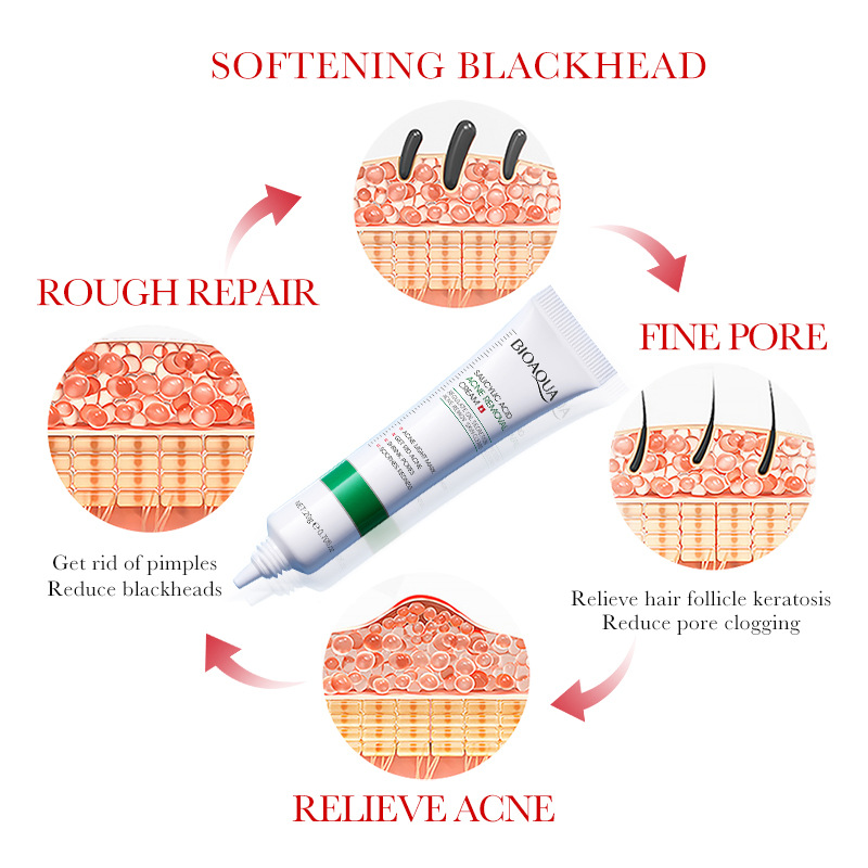1/2/3 шт. BIOAQUA крем для лиц – обзор и цена Azelaic Acid Cream