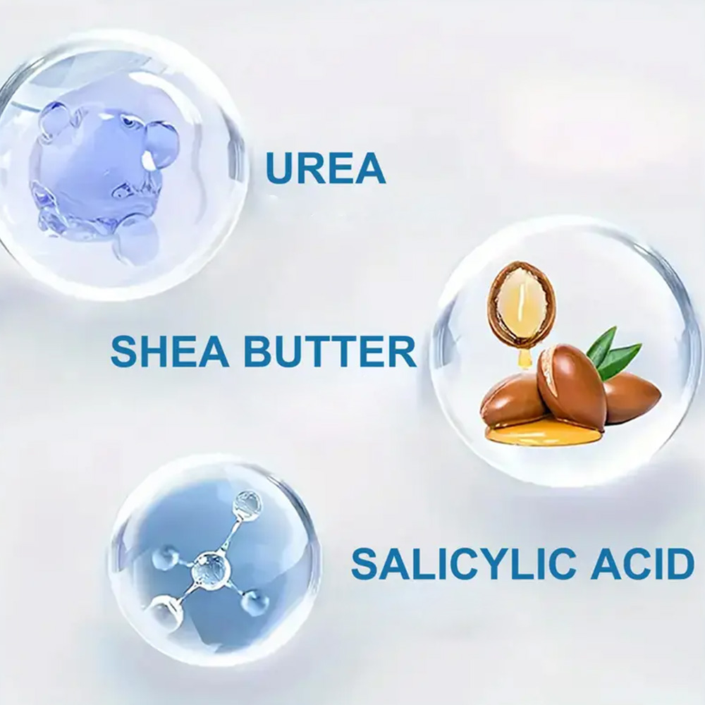 YOUNGCOME 250 г крем мочевины  – обзор и цена Azelaic Acid Cream