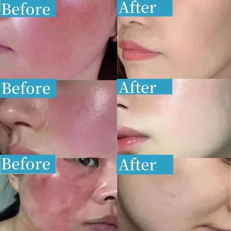 Корейский крем для лица от пок – обзор и цена Coenzyme Q10 Cream