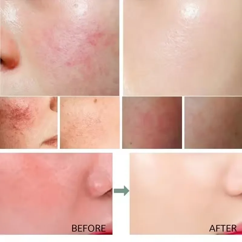 Восстанавливающий крем для лиц – обзор и цена Coenzyme Q10 Cream